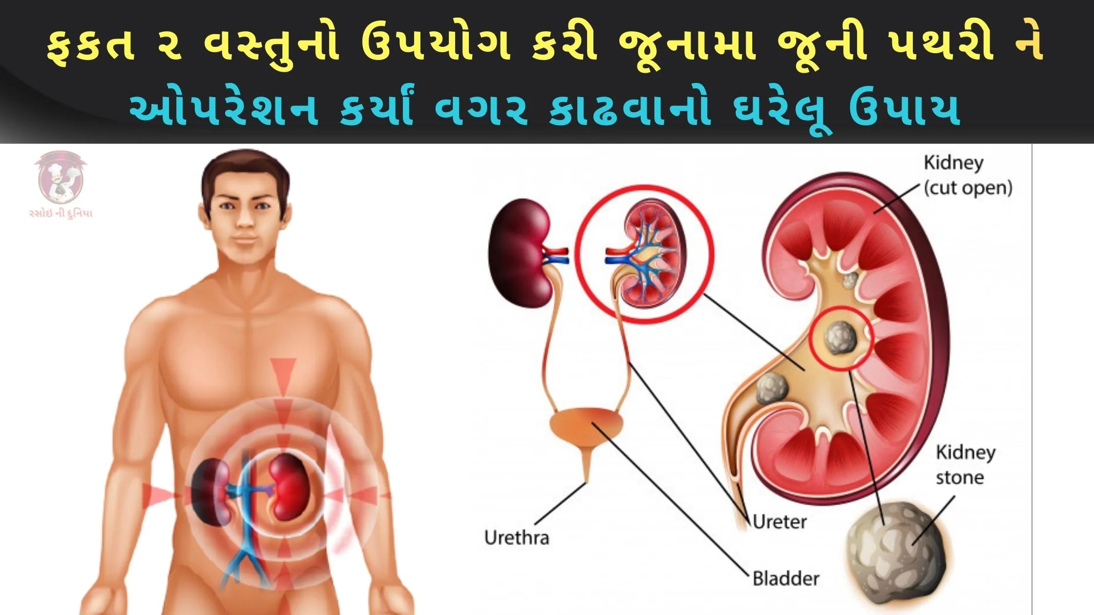 pathari no desi upay in gujarati