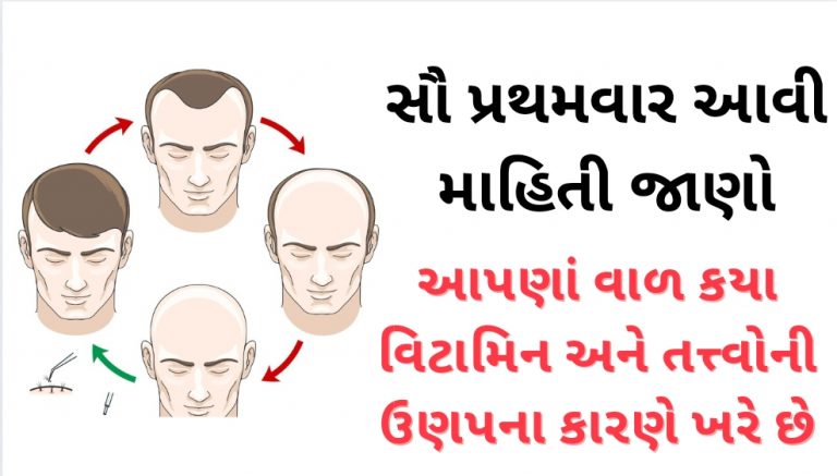 જાણો વાળ માટેના વિટામિન, વાળ ખરવાના કારણો અને તેના ઉપાયો