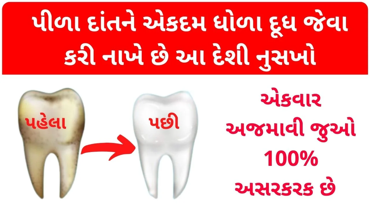dant saaf karvani rit