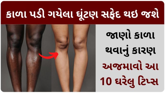 ઘૂંટણ કાળા પડી ગયા છે તો થઇ જશે સફેદ, આ 10 ટીપ્સને અનુસરો dark knees home remedies in gujarati