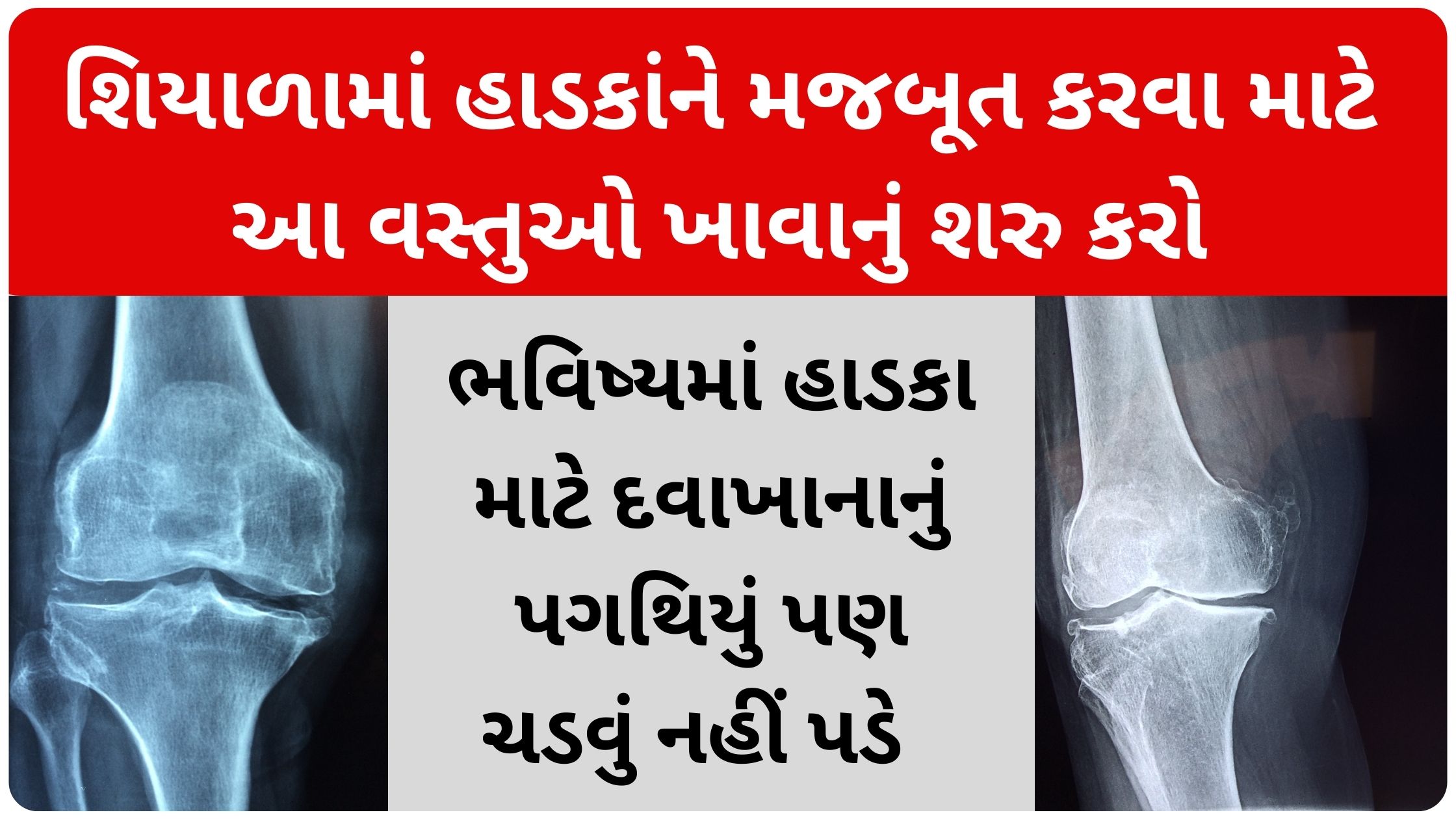 winter best food for bone health